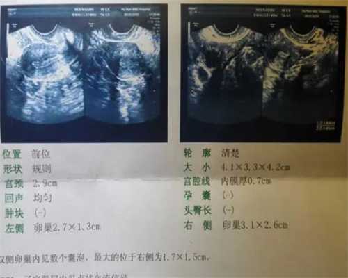 影响浙江省妇幼保健试管费用的因素有哪些？