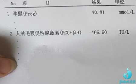 杭州正规医院代孕孩子,试管婴儿怀双胞胎好吗